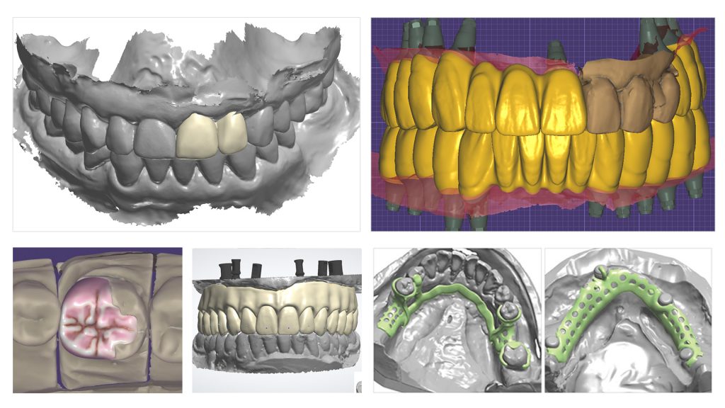 Workplace dental technician. Production of dental crowns. Milling dental system with computer control. Grinding and milling machine of dentures. Laboratory milling cutter for dental work. Dentistry.