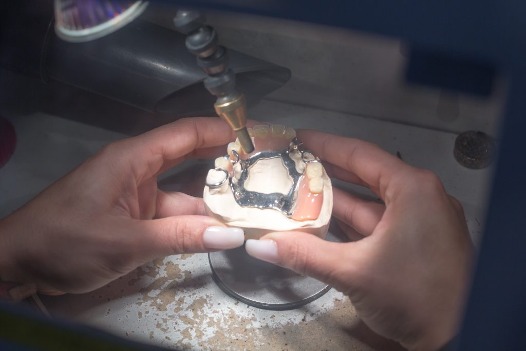 Dental technician manufacturing a prosthesis with a laser